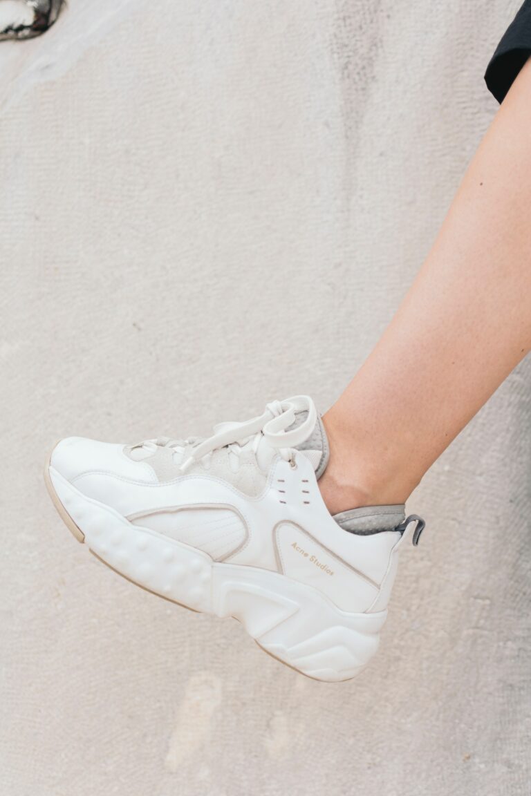 How to remove yellow stains from white shoes
